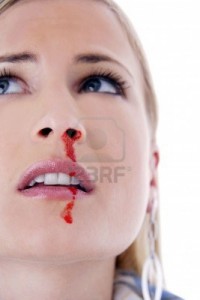 3191832-woman-with-a-nosebleed