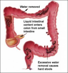 Constipation-during-Pregnancy