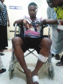 survivors-of-the-bomb-blasts-in-the-hospital-in-kano-...-on-tuesday