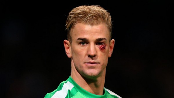 Joe Hart Suffered a gash to His Face in Sunday's 1-0 Win Over Crystal Palace. 