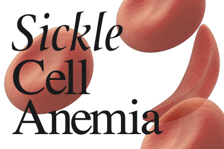 sickle cell